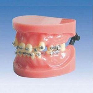 Fixed rectify teeth model (misplaced)